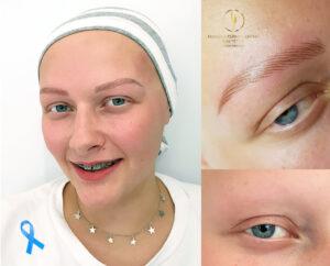 Mikropigmentacja medyczna, makijaż permanentny medyczny